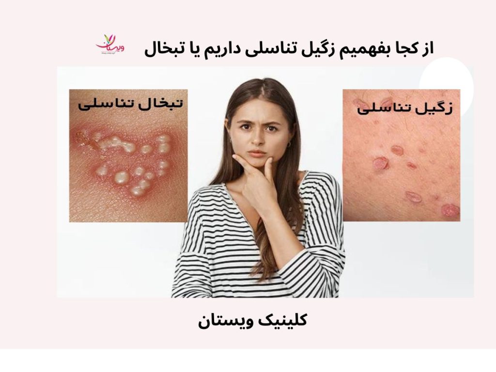 درمان زگیل تناسلی در زنان چقدر طول میکشد؟